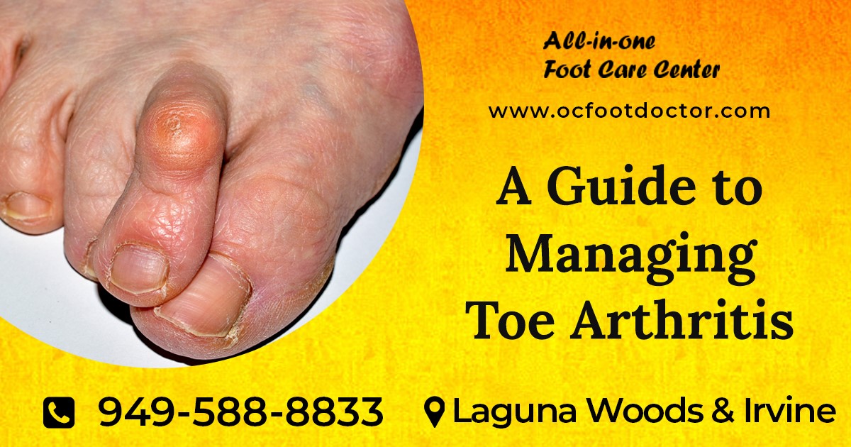 A Guide to Managing Toe Arthritis