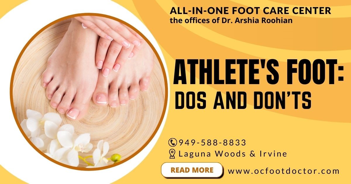 Athlete's Foot Dos and Don'ts