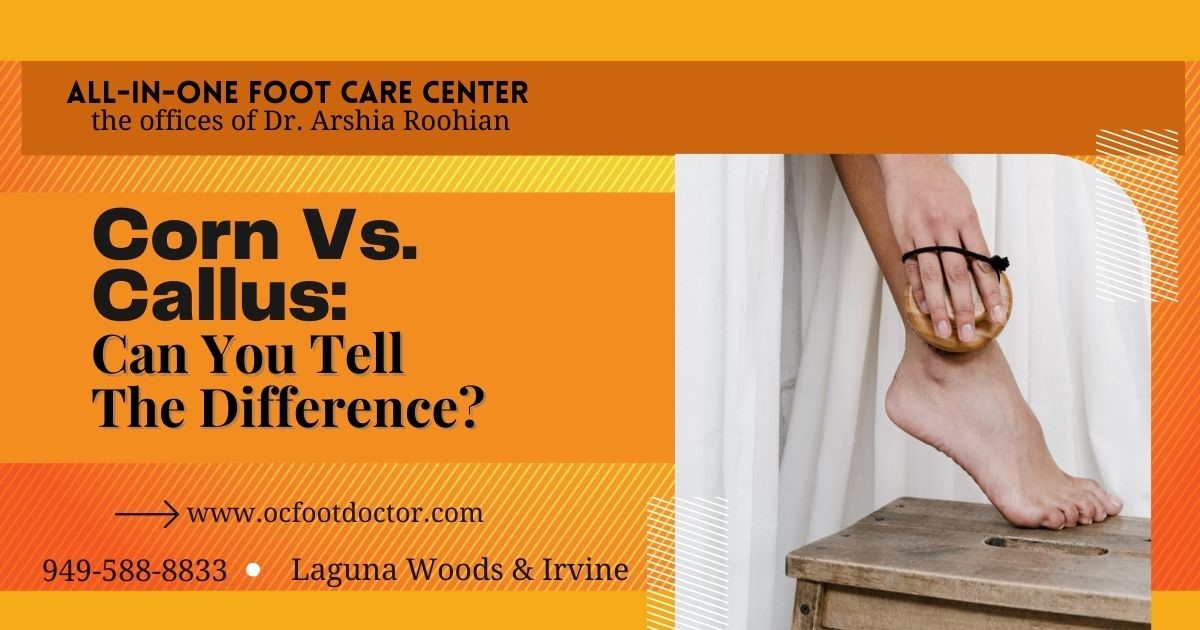 Corn Vs. Callus Can You Tell The Difference?