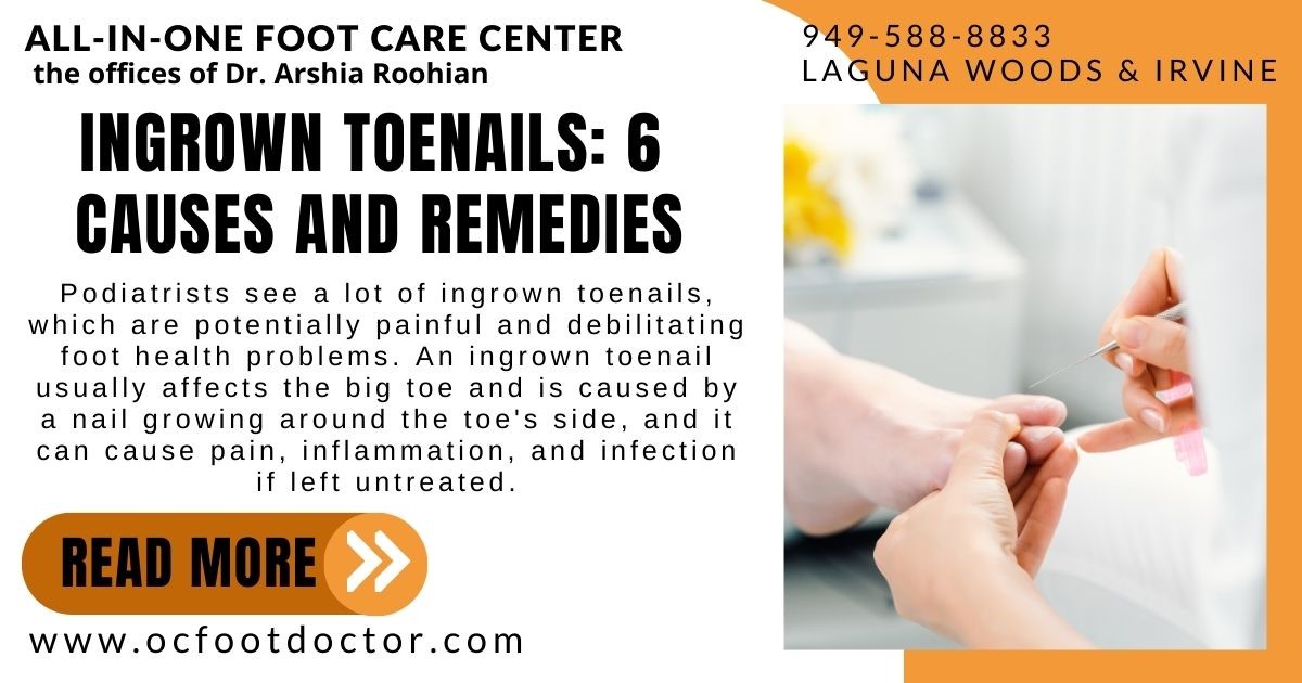 Ingrown toenails 6 Causes and Remedies