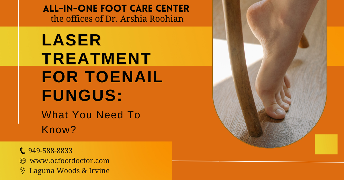 Laser Treatment For Toenail Fungus What You Need To Know?