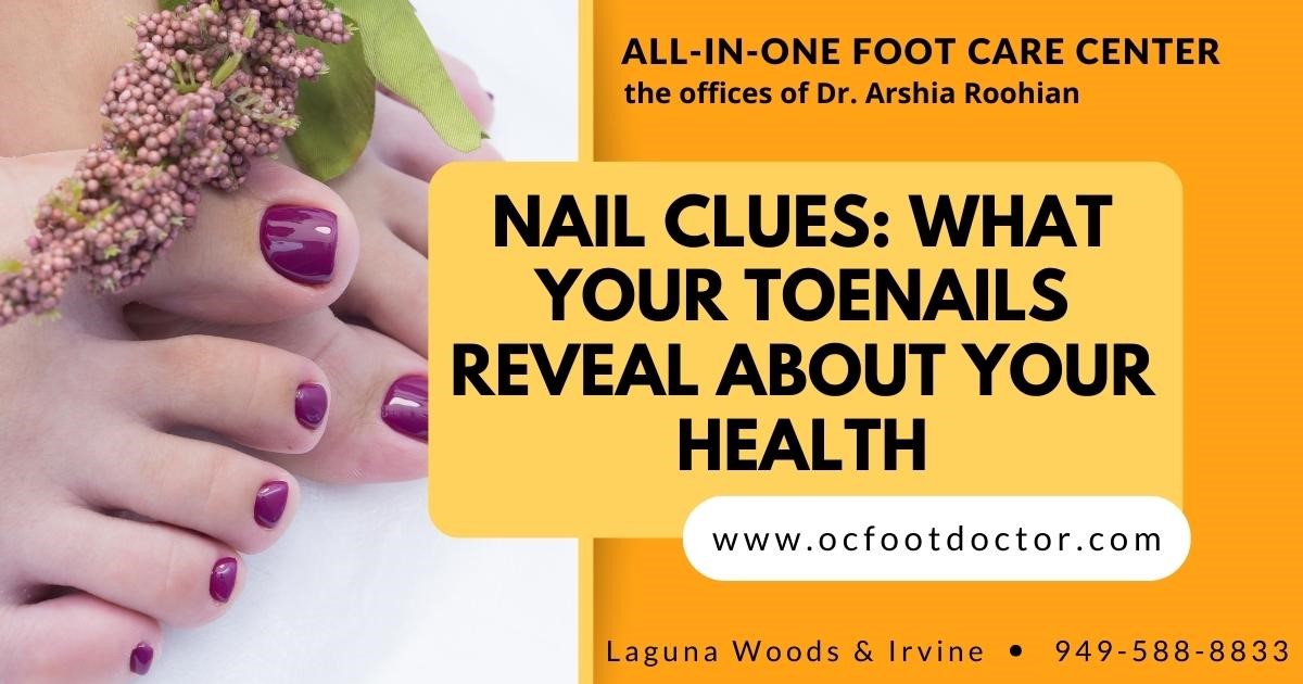 Nail Clues What Your Toenails Reveal About Your Health