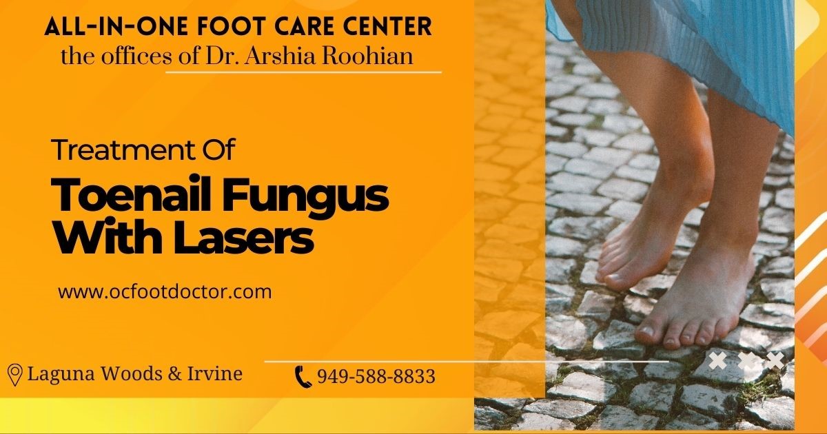 Treatment Of Toenail Fungus With Lasers